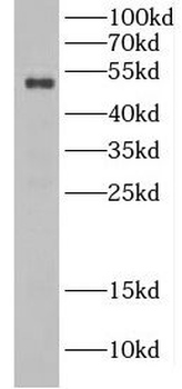 CSNK1G1 Rabbit Polyclonal Antibody