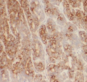 CSNK1G1 Rabbit Polyclonal Antibody