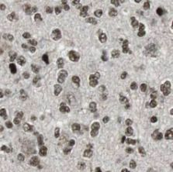 CSNK2A1 Antibody