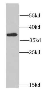 CSNK2A2 Antibody