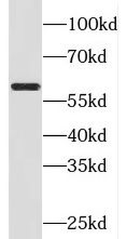 SRC Rabbit Polyclonal Antibody