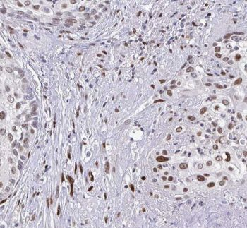 CSRP1 Antibody