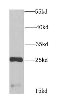 CSRP3 Antibody