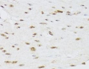 CSRP3 Antibody