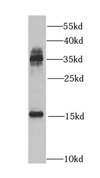CST1 Antibody