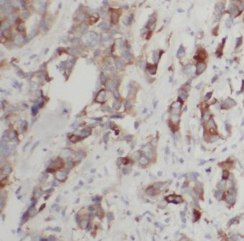 CST6 Rabbit Polyclonal Antibody