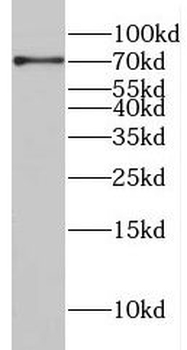 CSTF2T Rabbit Polyclonal Antibody