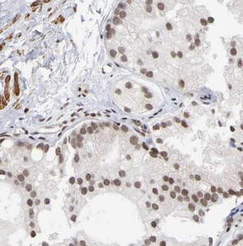 CSTF2T Antibody