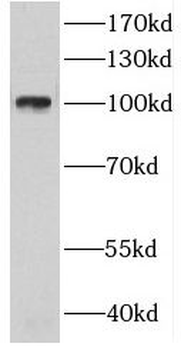 CTAGE6 Antibody