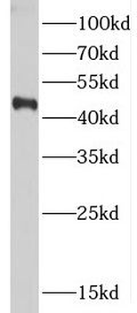 CTBS Antibody