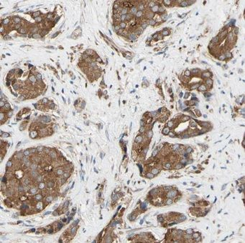 CTBS Antibody