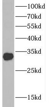 CTDSP1 Antibody