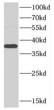 CCN2 Rabbit Polyclonal Antibody