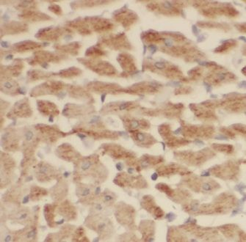 CCN2 Rabbit Polyclonal Antibody