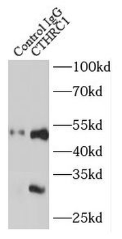 CTHRC1 Antibody