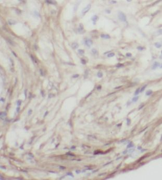 CTHRC1 Antibody