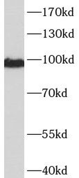 CTNNA1 Mouse Monoclonal Antibody