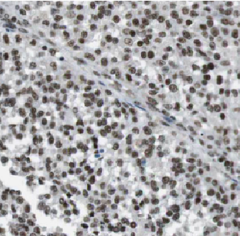 CTNNBL1 Antibody