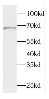 CTPS2 Antibody