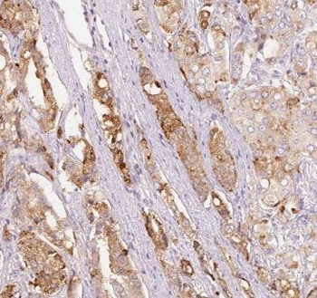 CTPS2 Antibody