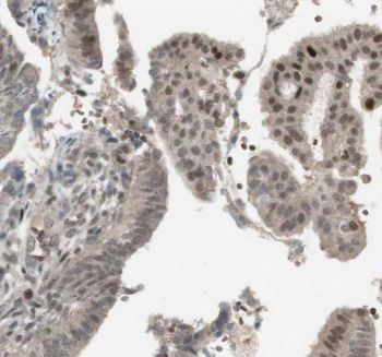 CTR9 Antibody