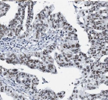 CTR9 Antibody