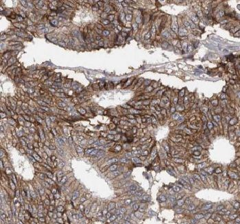 C1QTNF1 Antibody