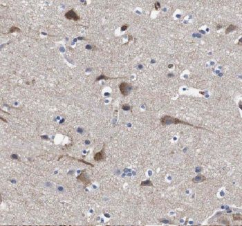 C1QTNF4 Antibody