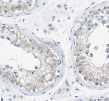 CTTNBP2 Antibody