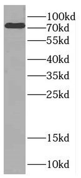 CTTNBP2NL Antibody