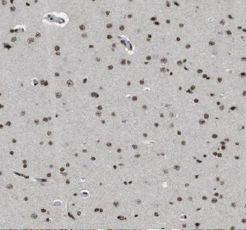 CUEDC2 Antibody