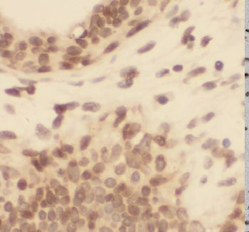 CELF1 Antibody