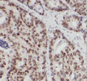 CELF2 Antibody