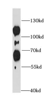 CUL3 Rabbit Polyclonal Antibody