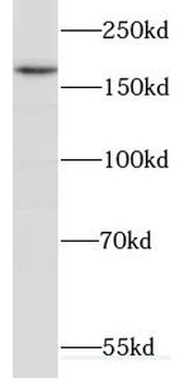 CUL7 Antibody