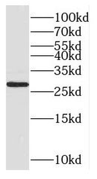 CUTC Rabbit Polyclonal Antibody