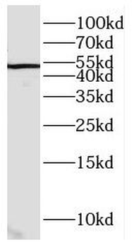 CWC25 Antibody
