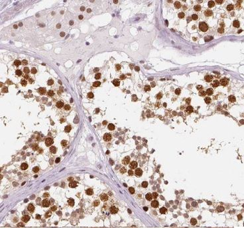 CWC25 Antibody