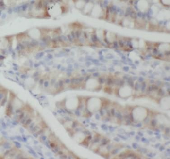 CX3CL1 Antibody