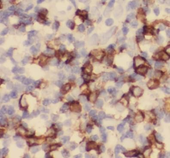 CX3CR1 Antibody