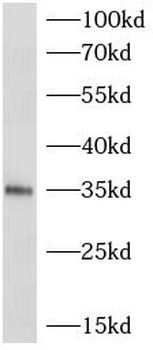 CXCL16 Mouse Monoclonal Antibody