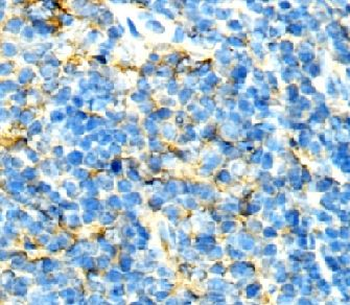 CXCR2 Antibody