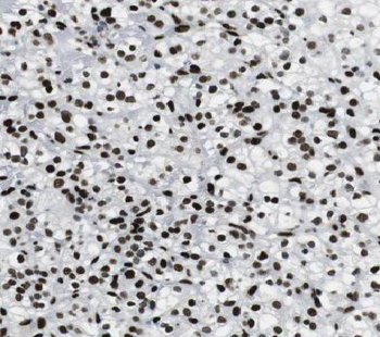 ACKR3 Antibody