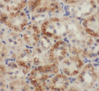 PBDC1 Antibody