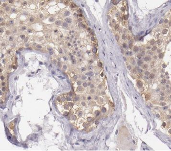 CYB5B Antibody