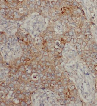 CYB5R1 Antibody