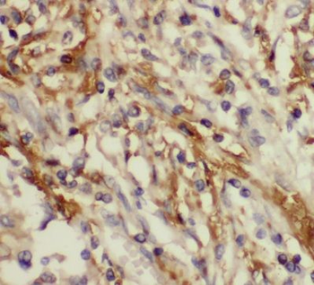 CYB5R3 Antibody