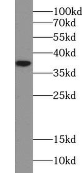 CCND1 Mouse Monoclonal Antibody