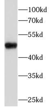 CCNE1 Rabbit Polyclonal Antibody