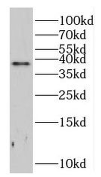 CCNH1 Rabbit Polyclonal Antibody